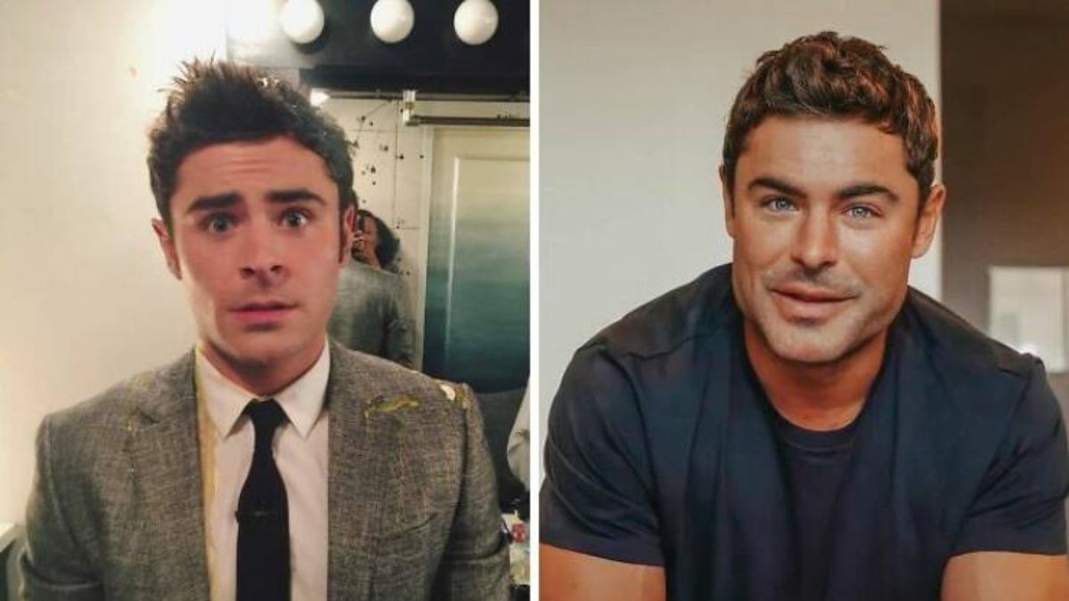 10 Famous Celebrities Before and After Cosmetic Surgery